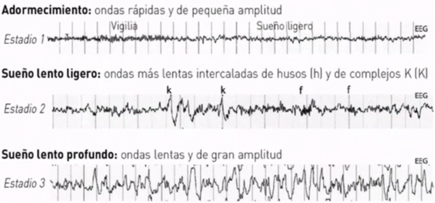 Ondas del son no-REM